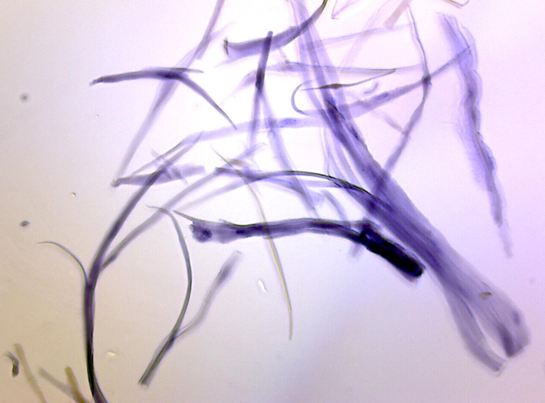 平滑肌（平滑肌分離）