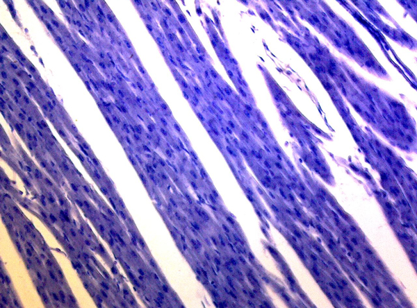 心肌縱切（蘇木精）