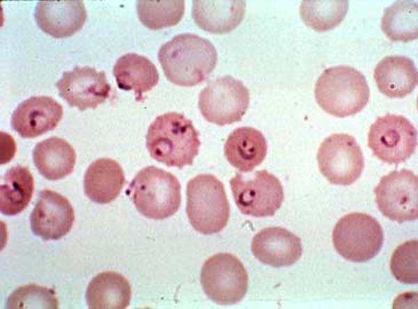 惡性瘧原蟲滋養(yǎng)體