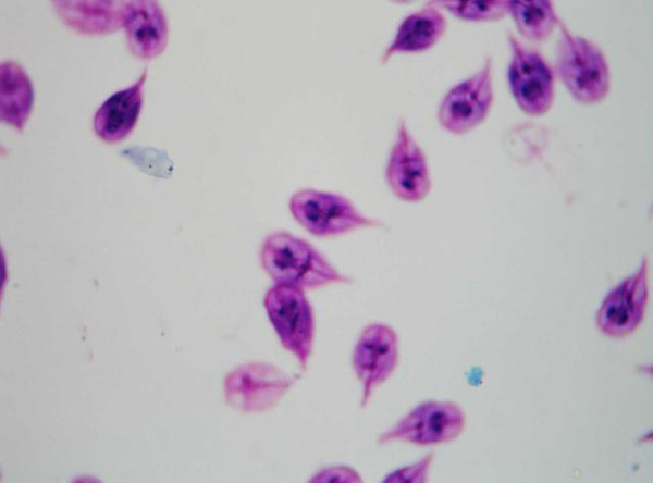 賈第蟲滋養(yǎng)體