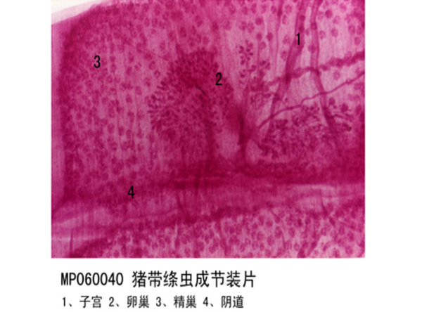 豬帶絳蟲成節裝片