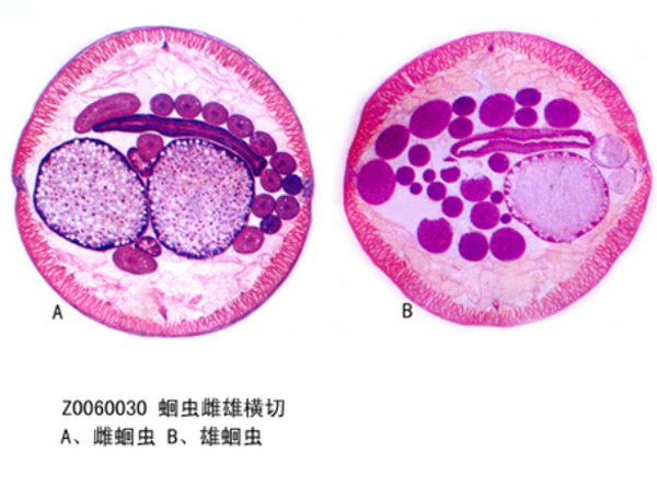 蛔蟲雌雄橫切