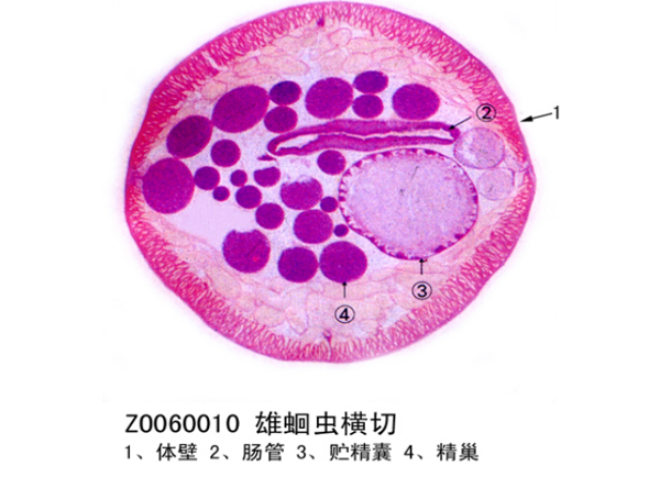 雄蛔蟲橫切