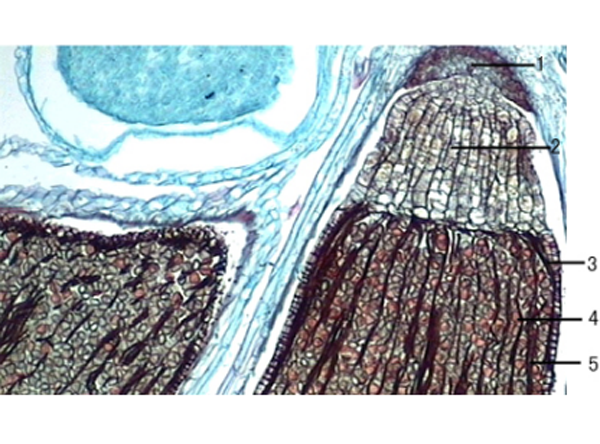 地錢孢子體縱切